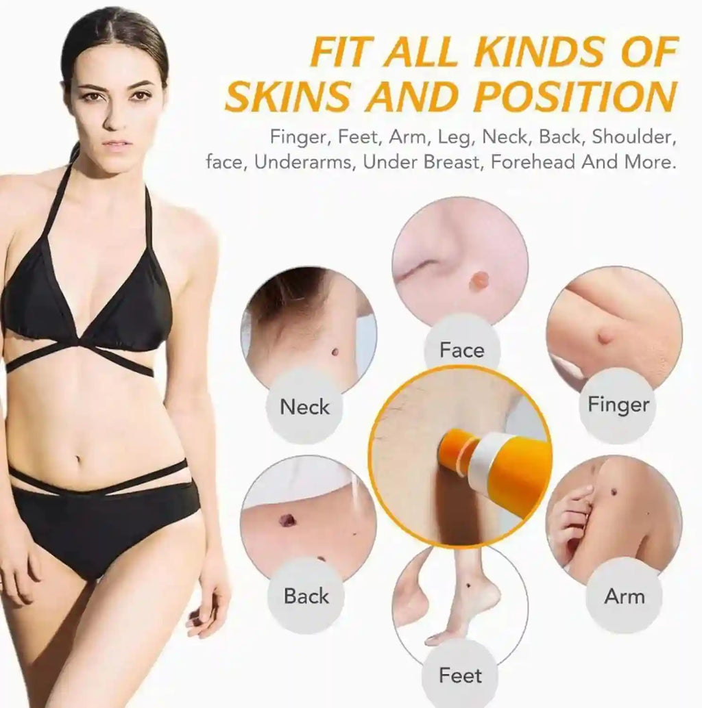 2-in-1 painless skin tag and mole removal kit for face and body. Includes orange applicator for at-home wart removal.