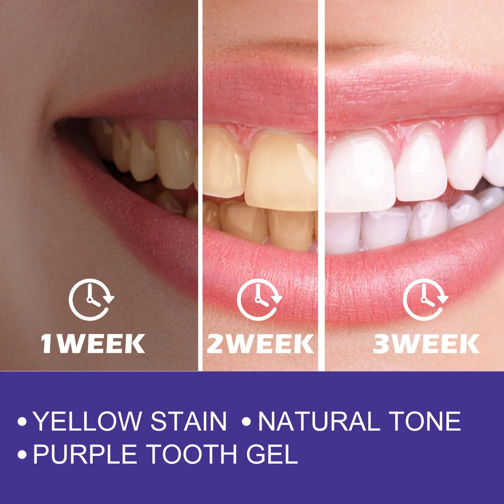 Tidesmit purple whitening toothpaste for removing yellow stains and freshening breath in daily oral care routine
