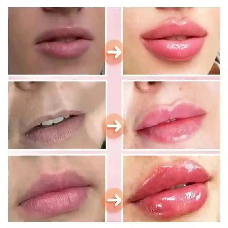 Volumizing Lip Serum: Hydrating Plumper for Fuller, Nourished Lips Lip Care Tidesmit