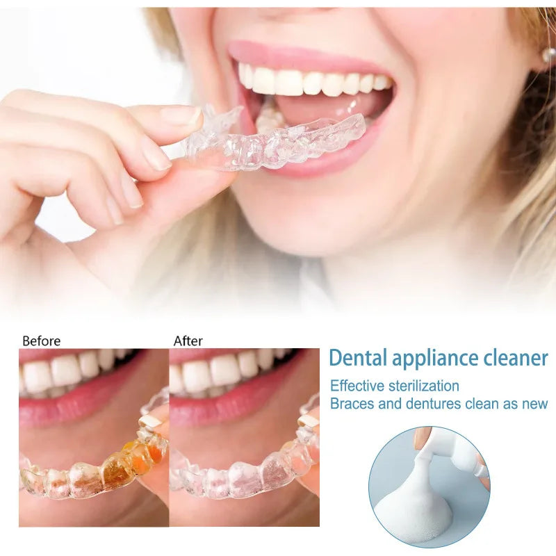 Tidesmit 30ml Aligner Denture Cleaner Foam for deep cleaning, stain removal, and fresh breath retainer care.
