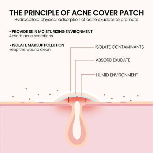 Acne cover patch cross-section diagram showing absorb exudate and a humid environment