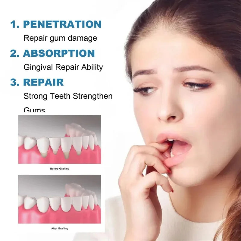 Tidesmit 50ml damage repair gum serum for teeth whitening, tooth sensitivity relief, and dental cavity cleaning.