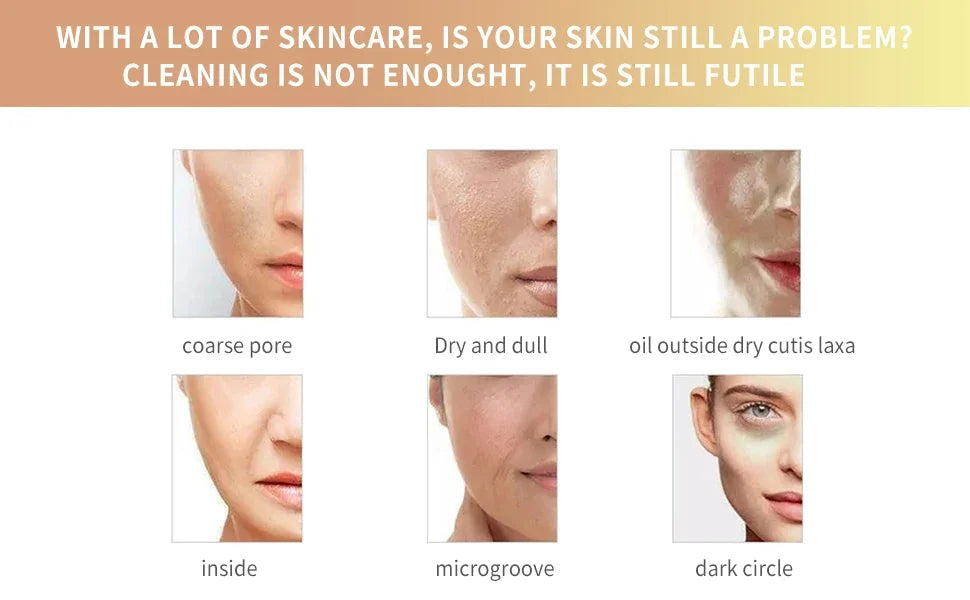 Six close-up photos showing skin concerns: coarse pores, dryness, oiliness, loss of elasticity, lines, and dark circles.
