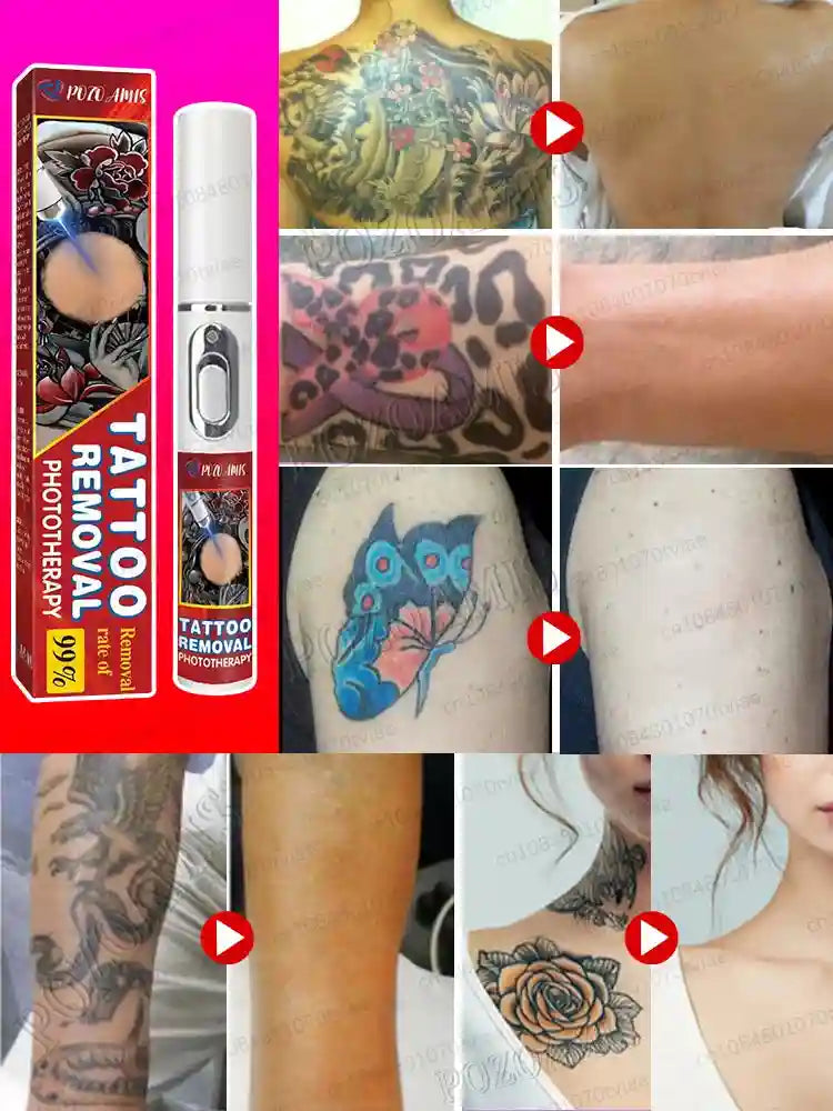 Tattoo Removal Cream for Body and Face - Professional Fast Action Formula Scrubs Treatments Tidesmit