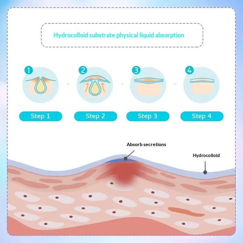 Colorful Star Butterfly Pimple Patch Gentle Hydrocolloid   Stickers for Skin Blemish Recovery and Care