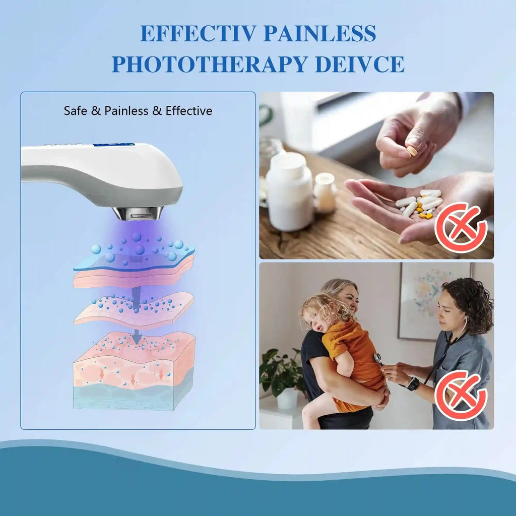 White handheld phototherapy device showing light penetration into skin layers as an alternative to pills or doctors.