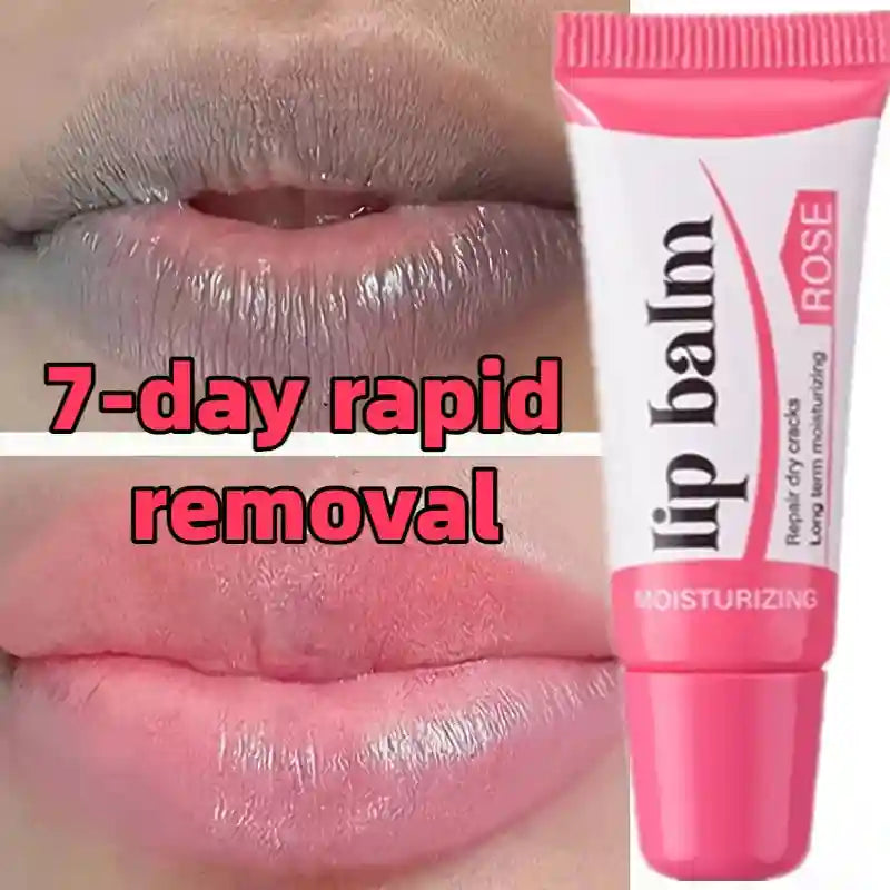 Dark Lip Lightening Mask | Exfoliating Lip Treatment Balm 10g Lip Care Tidesmit