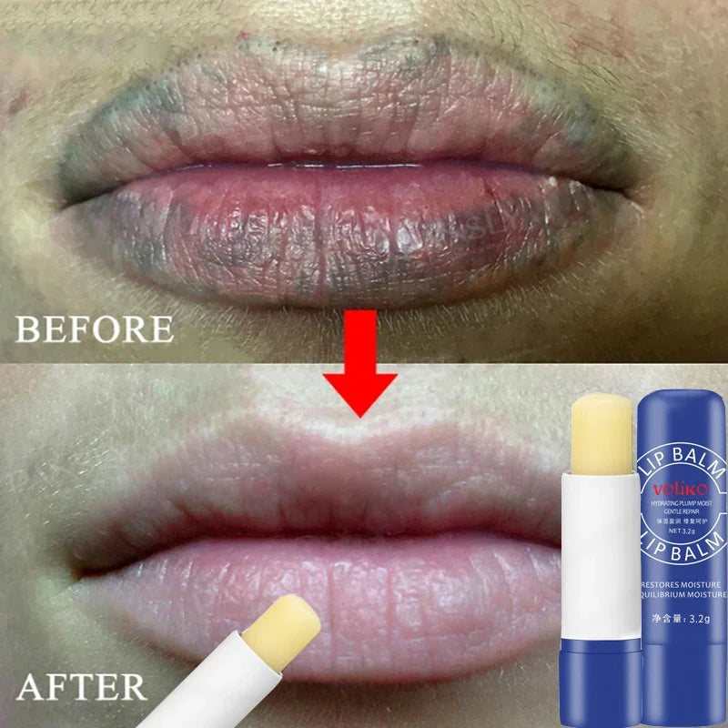 Dark Lip Lightening Balm - Exfoliating Lip Care Treatment by Tidesmit Lip Care Tidesmit