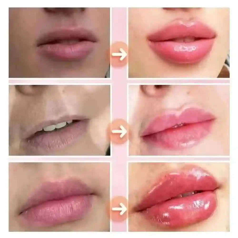 Lip Plumping Serum With Hyaluronic Acid - Hydrating Lip Treatment Lip Care Tidesmit