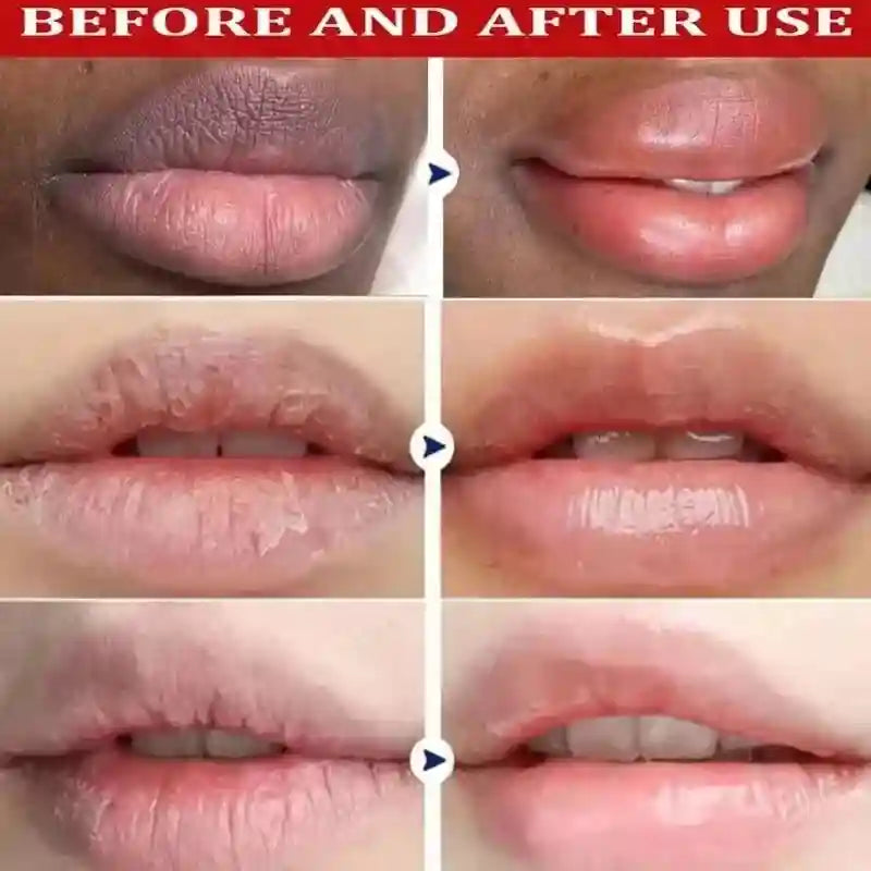 Dark Lip Lightening Serum - Exfoliating Lip Repair Balm by Tidesmit Lip Care Tidesmit