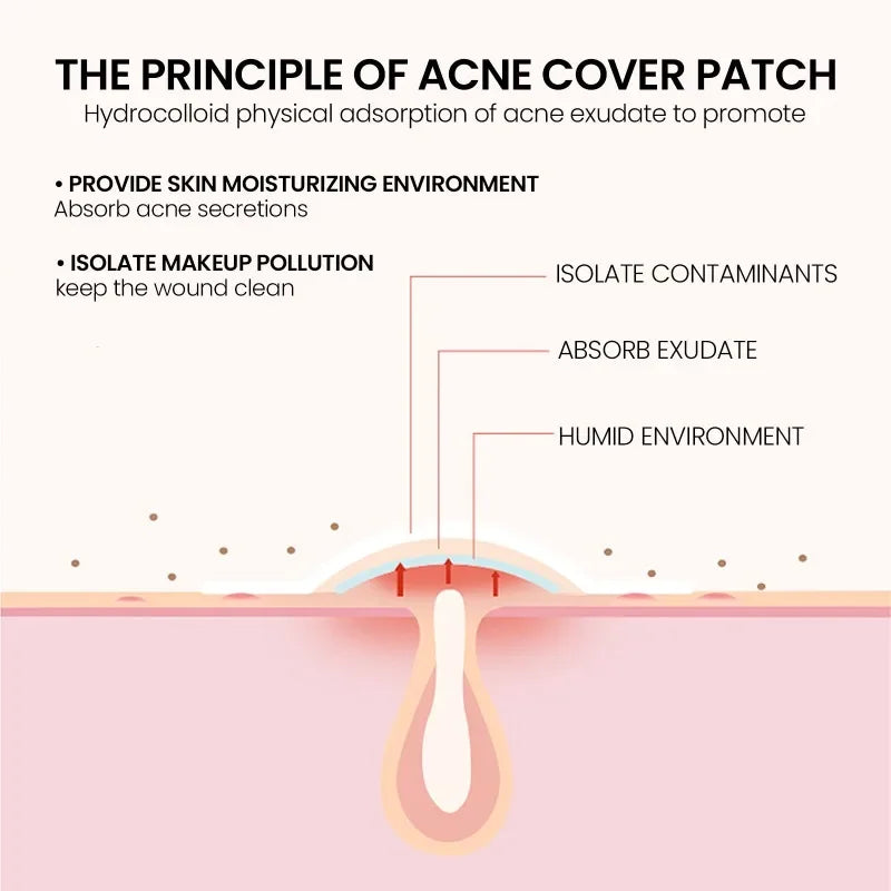 200/400pcs Acne Patches Invisible Pimple Cover for Face Oil Control Spot Treatment Cute Sticker for Covering Zits and Blemishes
