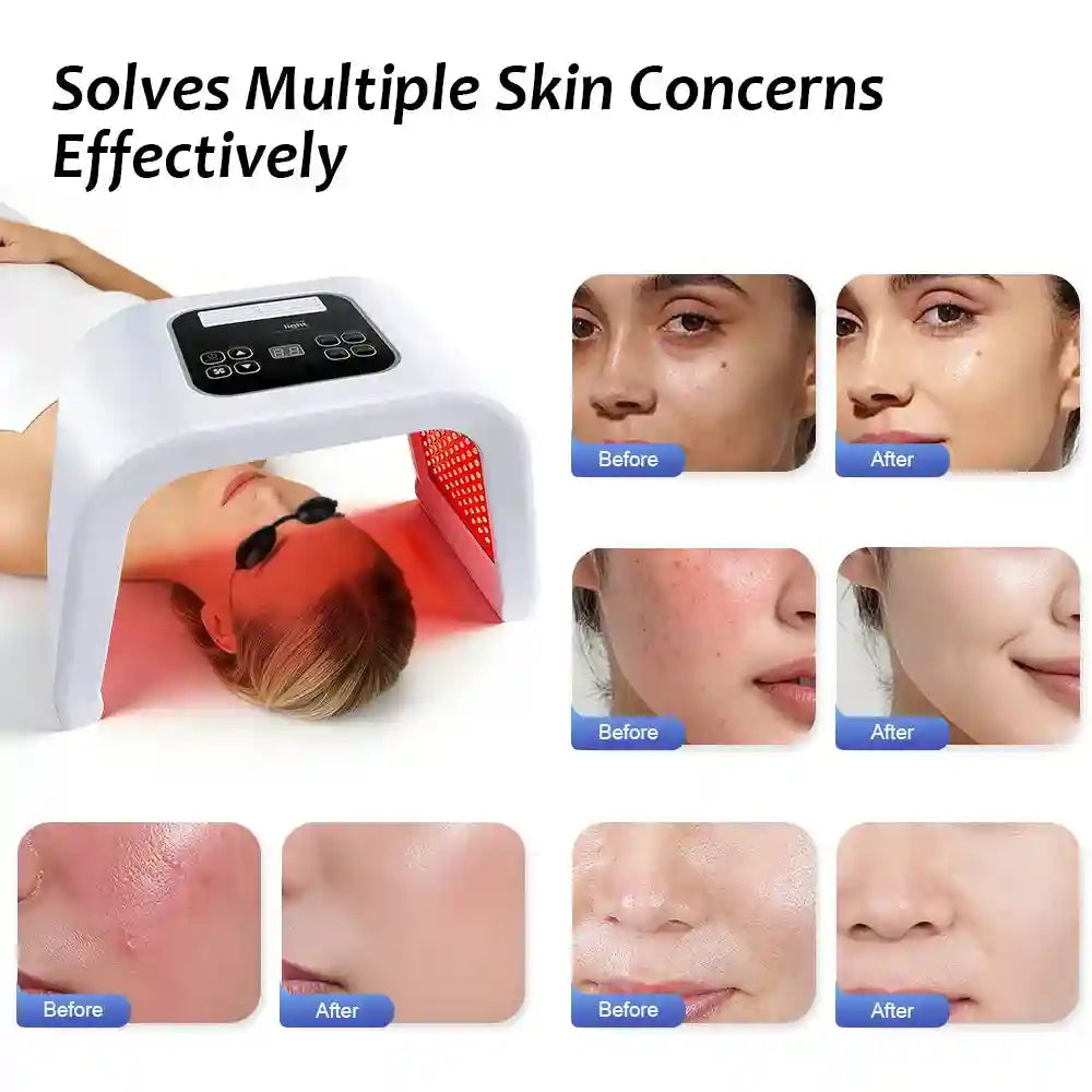 Eye Massage Instrument for Skin Rejuvenation & Firming - Tidesmit Eye Massage Instrument Tidesmit