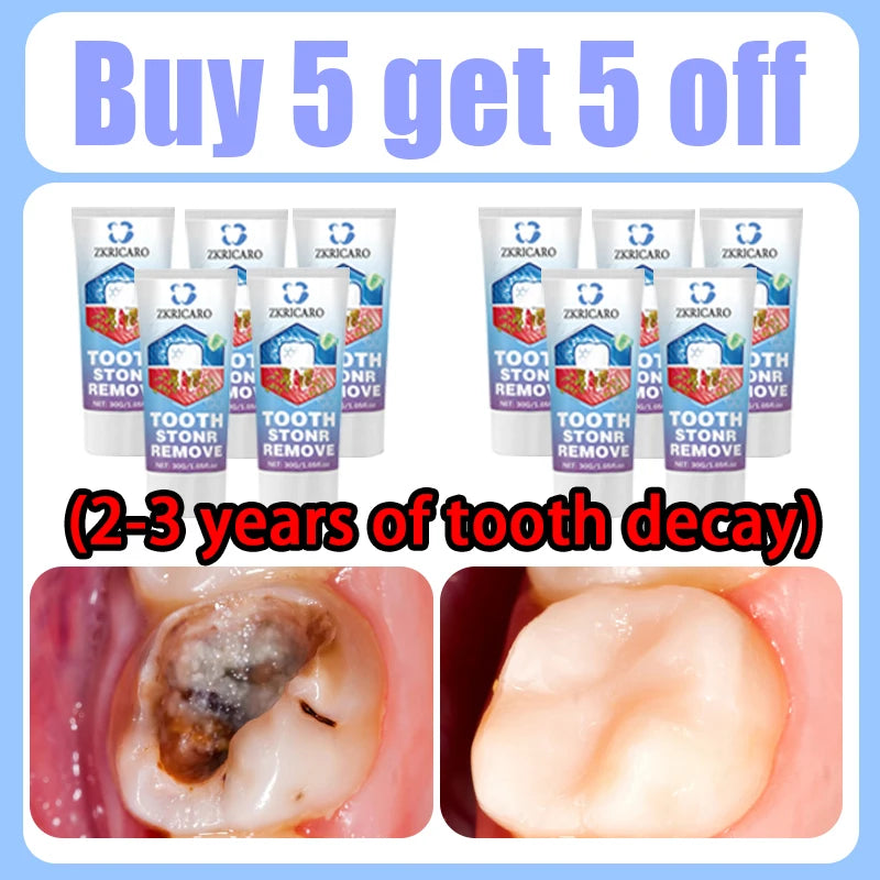 Teeth Whitening Scrub Paste | Deep Cleaning Dental Treatment Scrubs Treatments Buy 5 Get 5 Free Tidesmit