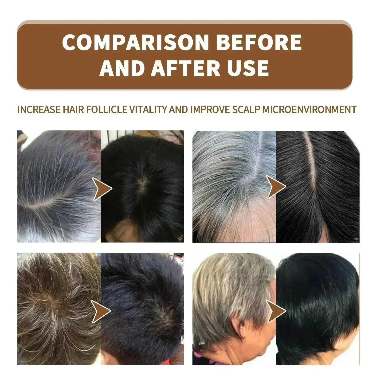Natural Hair Care Essence Serum Anti Gray Nourish Repair For All Hair Types