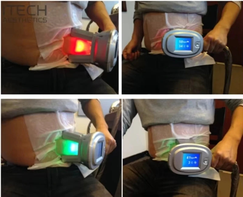 Antifreeze Membrane Pads for Cryotherapy - 10 PCS 42x34cm by Tidesmit Fascia Gun Tidesmit