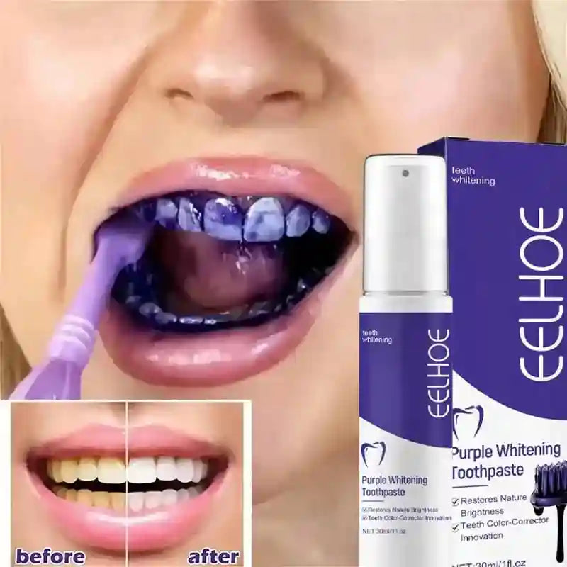 Tidesmit 2026 whitening toothpaste for effective yellow teeth removal and daily oral hygiene teeth cleaning