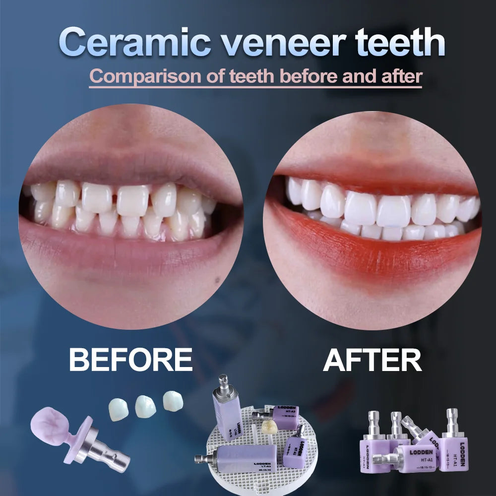 20PCS Lithium Disilicate Glass Ceramic Blocks CAD CAM Sirona Cerec LODDEN C14 Dental Lab HT LT MT Veneer Dentist Materials