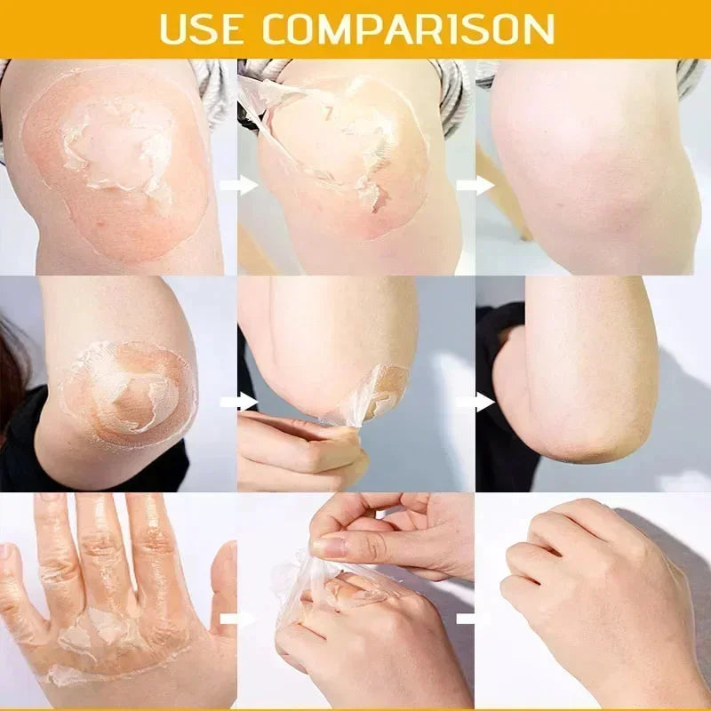 Yellow Peeling Oil for Dark Skin - Salon-Quality 100ml Exfoliating Treatment Scrubs Treatments Tidesmit