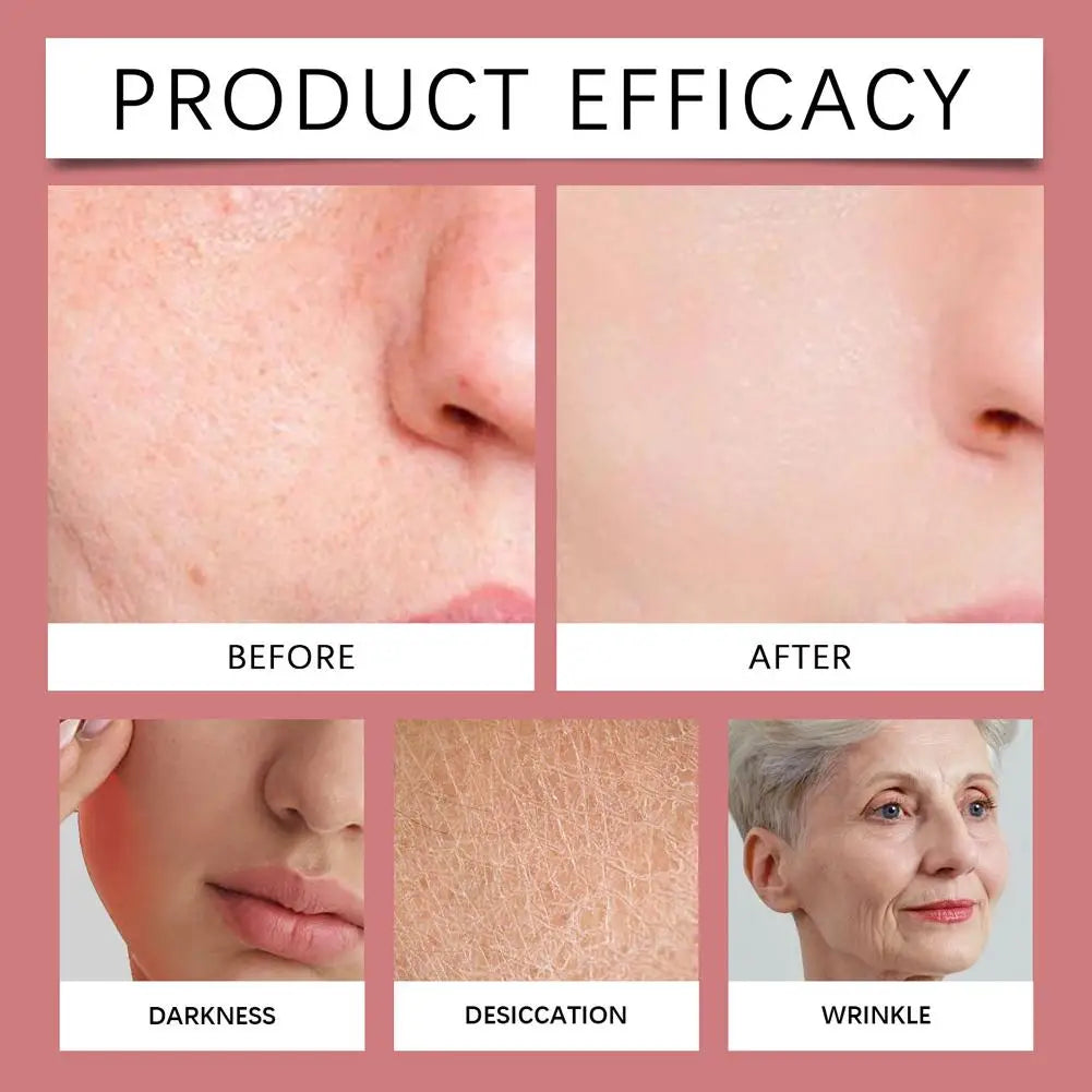 180pcs 0.2mm Facial Soothing Microneedle Patches Acne Care Patch Facial Skin Care Imperfection Patch