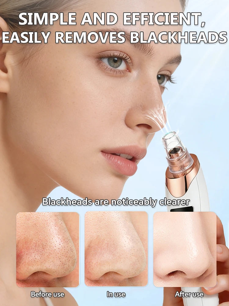 Electric blackhead vacuum remover tool cleaning facial pores and acne with before and after skin results comparison.