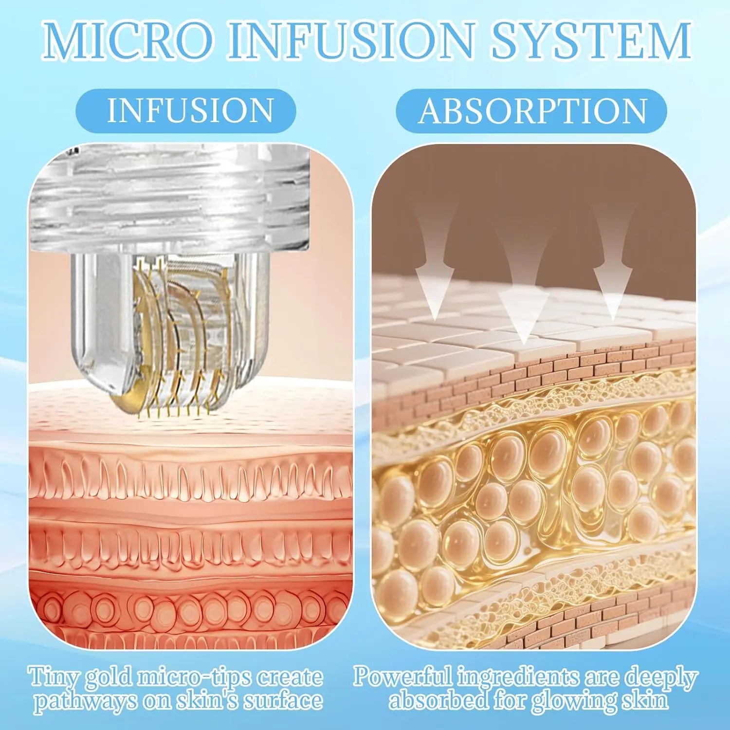 Tidesmit Micro Infusion Serum Kit 0.25mm needle facial tool for radiant flawless skin detail view