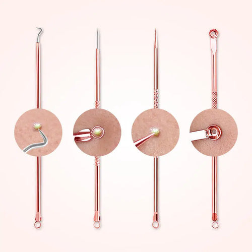 4-piece acne extractor needle tools with rose-gold stems and loop and round heads