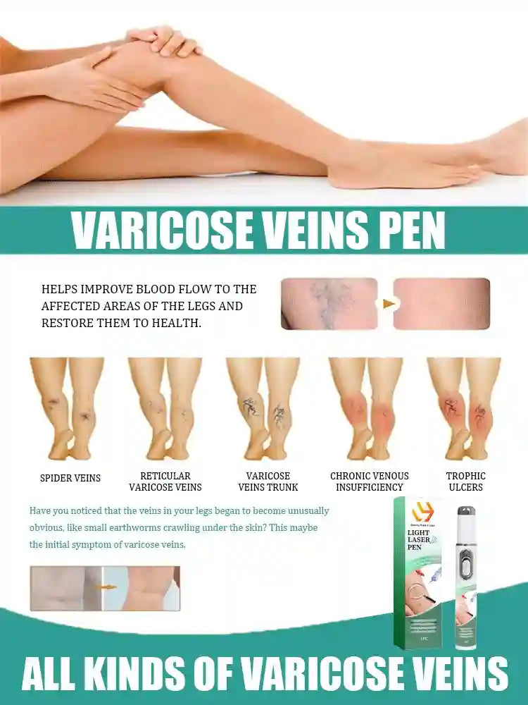 Portable light therapy laser pen for treating spider and varicose veins on legs, shown with before and after results.