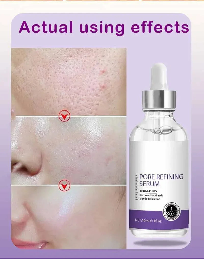 Retinol Niacinamide Serum - Professional PMU Machine Pore Refining Permanent Makeup Machines Tidesmit