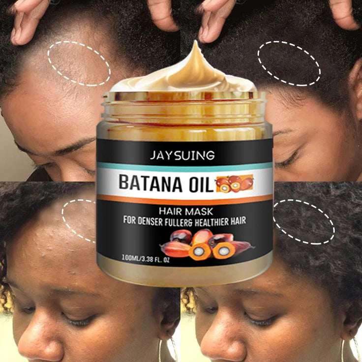 Tidesmit Batana Oil Hair Mask for fast hair regrowth, root repair, and treatment for traction alopecia and hair loss.