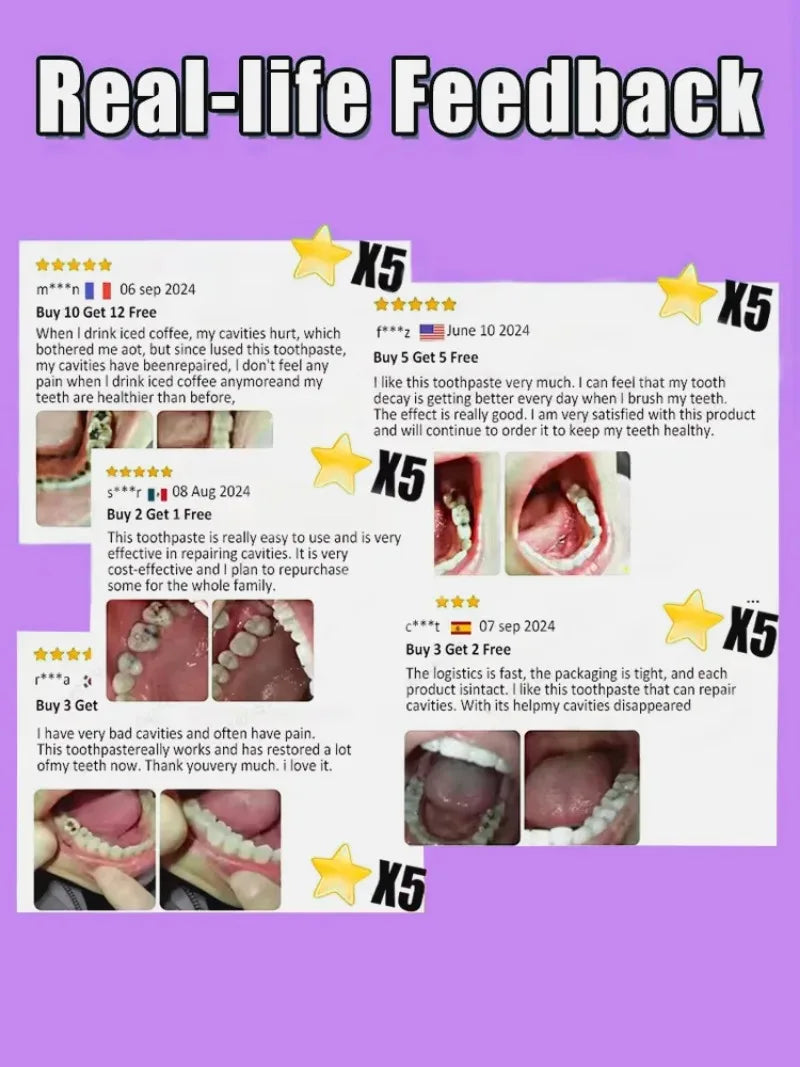 Tidesmit probiotic teeth whitening treatment for tooth decay repair and deep cleaning