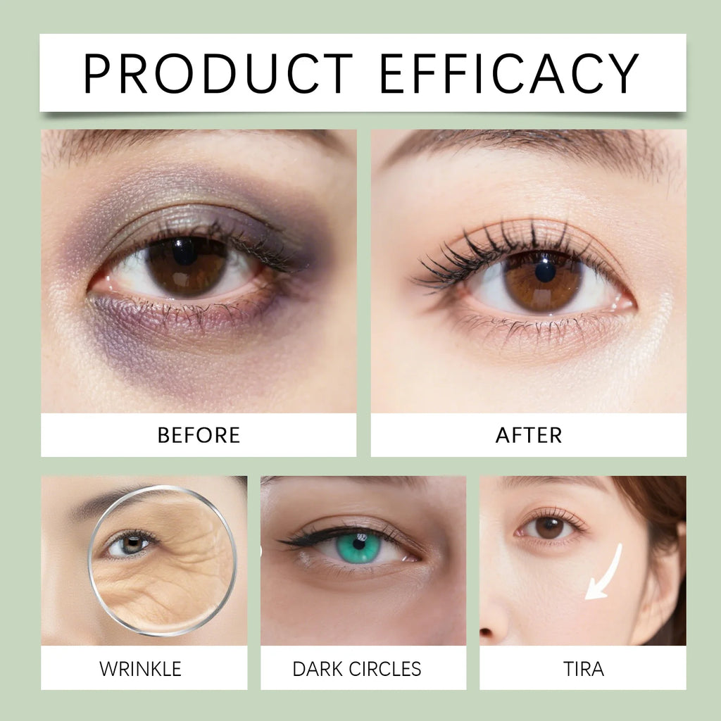 Hyaluronic Acid Eye Mask Anti Dark Circles Remove Eye Bags Improves Dullness Moisturizing Hydrating Eye Patches
