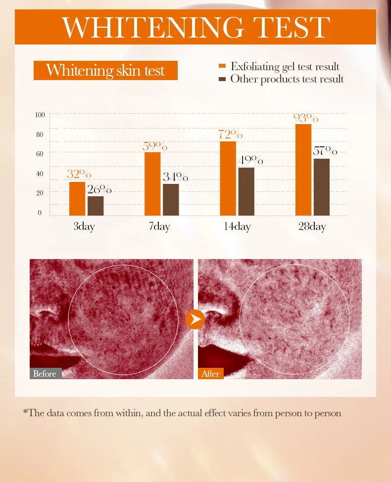 Orange Exfoliating Peeling Gel - Natural Salon-Quality Skin Resurfacing Scrubs Treatments Tidesmit