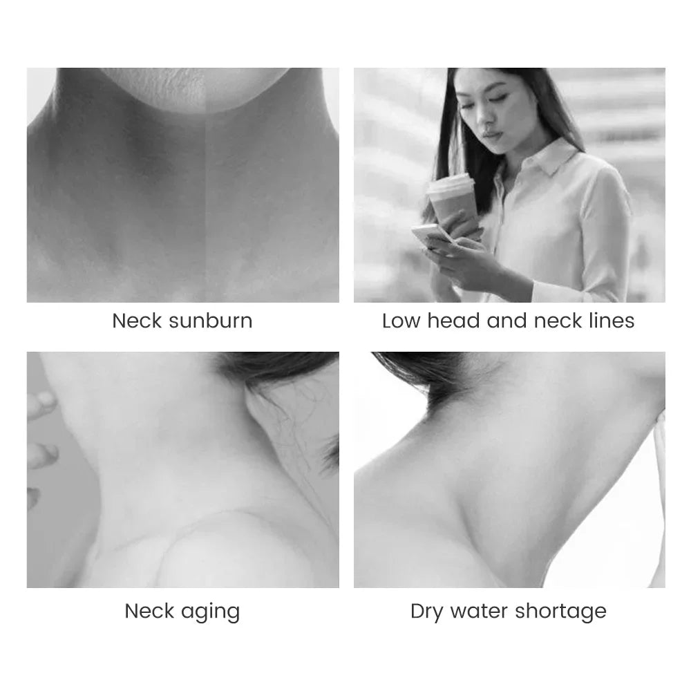 A four-panel grid showing common neck skin concerns: sunburn, wrinkles from posture, aging, and dryness.