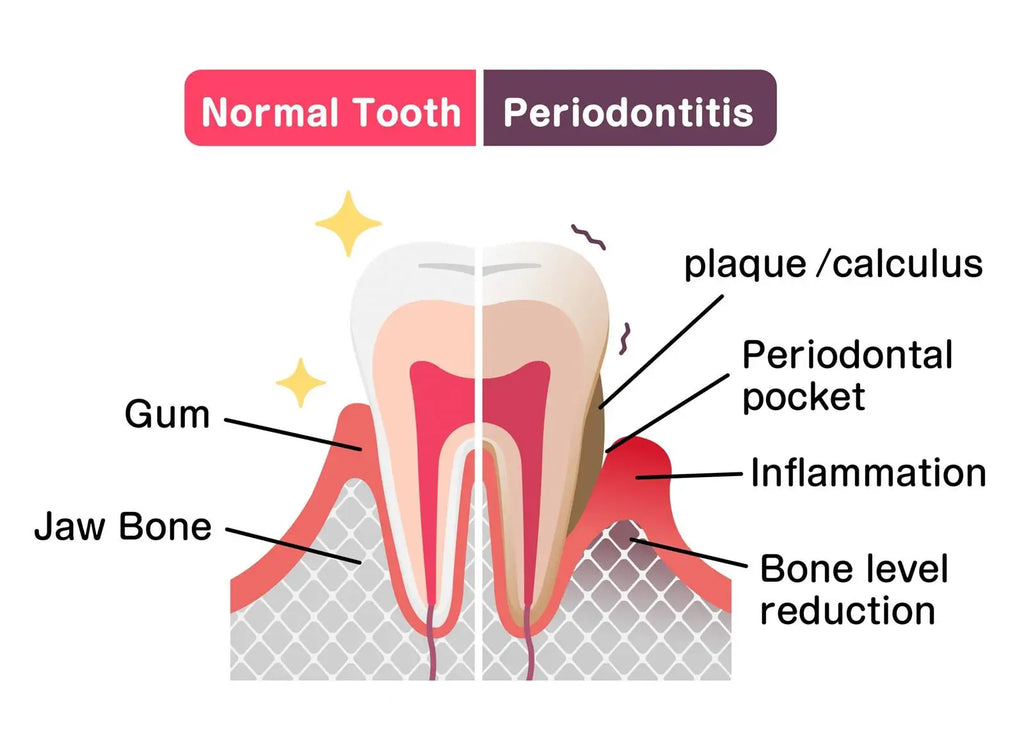 Tidesmit 50ml teeth whitening serum for gum repair, tooth allergy relief, and dental cavity protection.