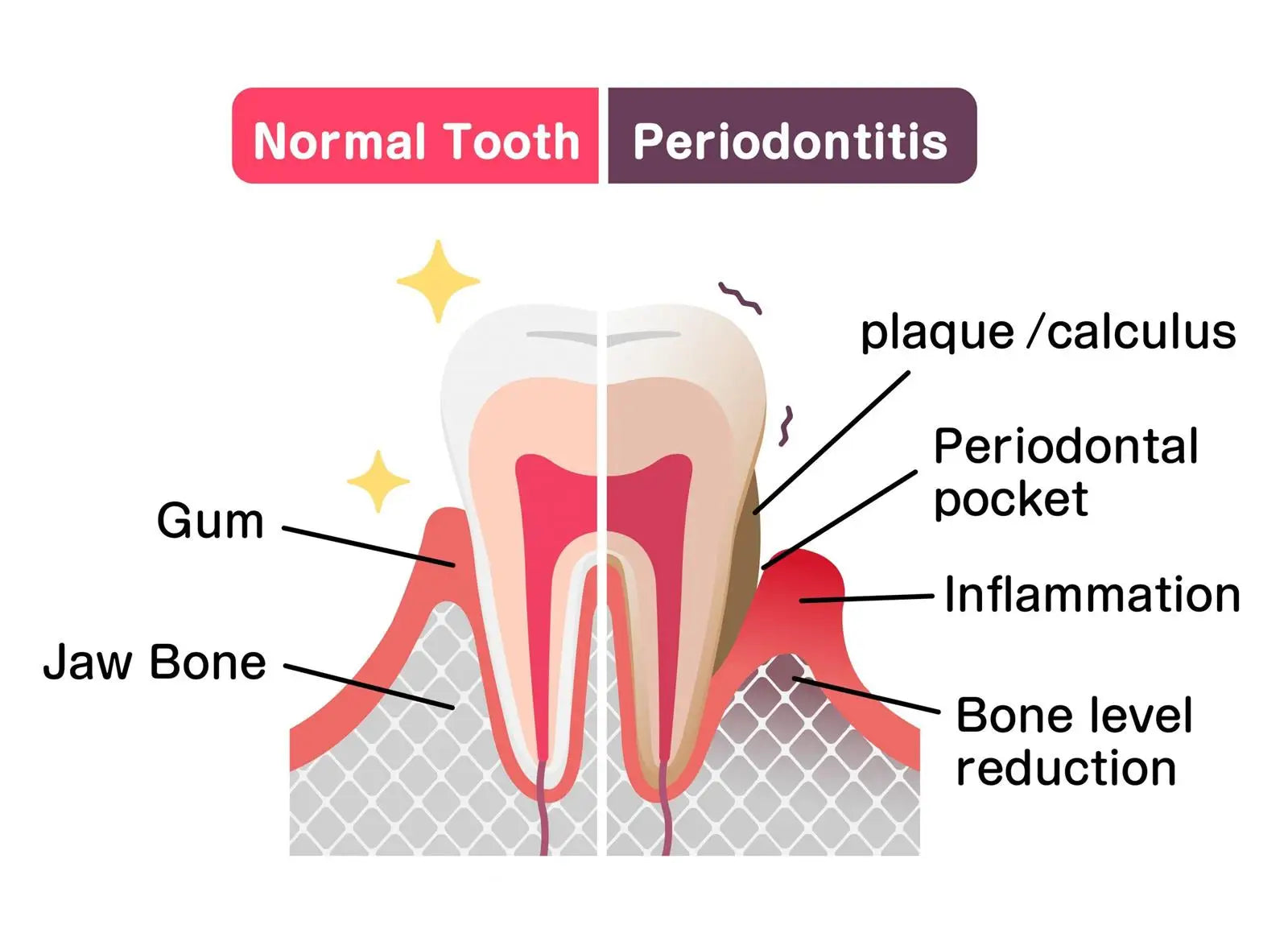 Tidesmit 50ml teeth whitening serum for gum repair, tooth allergy relief, and dental cavity protection.