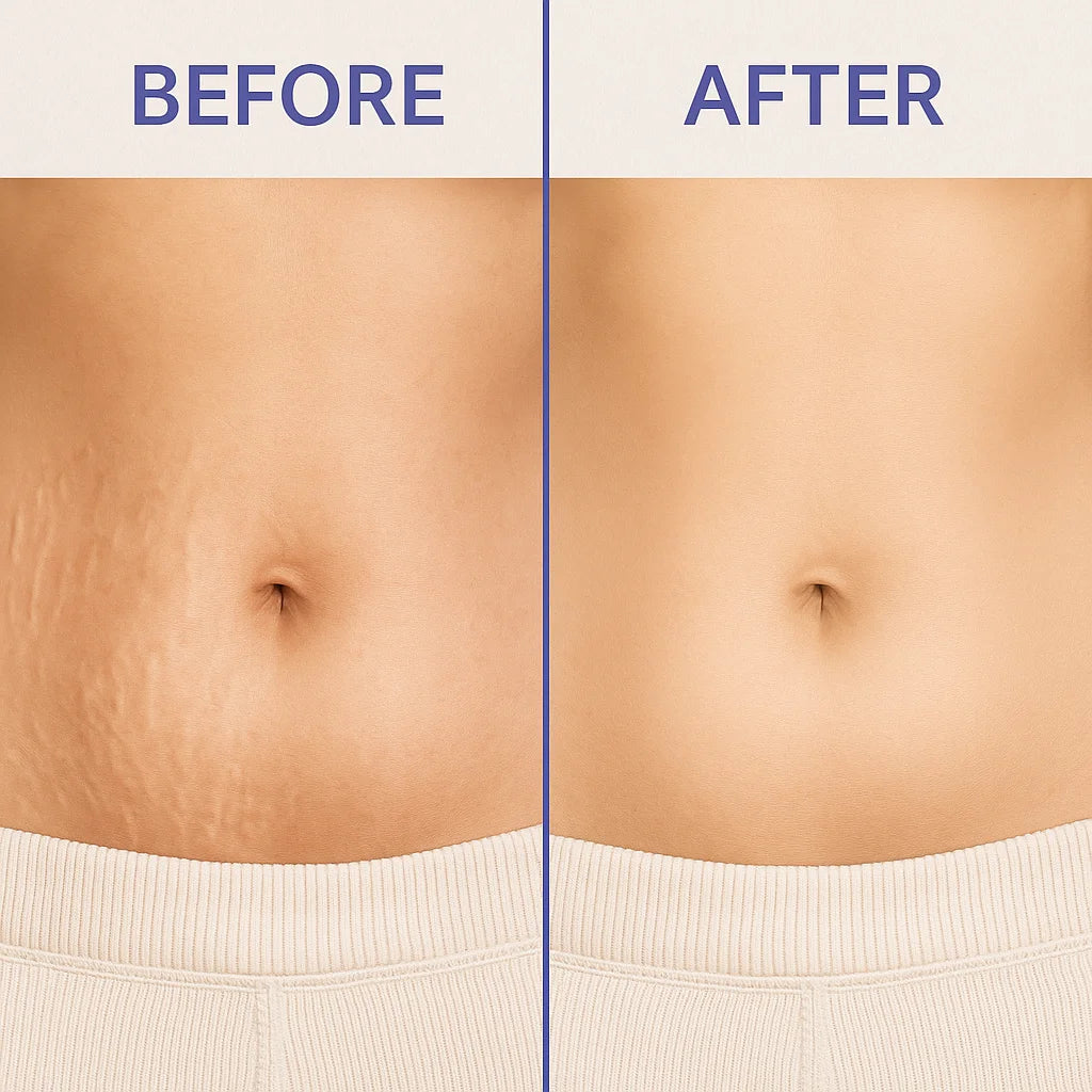 Tighten Smooth Belly Cream with Caffeine & Nicotinamide, Smoothing, Brightening, and Firming Body Lotion, 120g