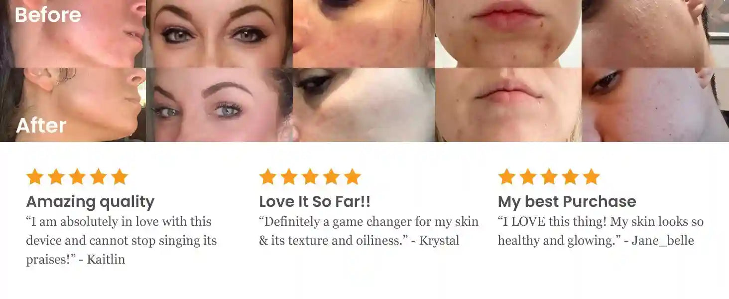 High Frequency Facial Wand: Acne Treatment & Skin Tightening - Purple Eye Massage Instrument Tidesmit