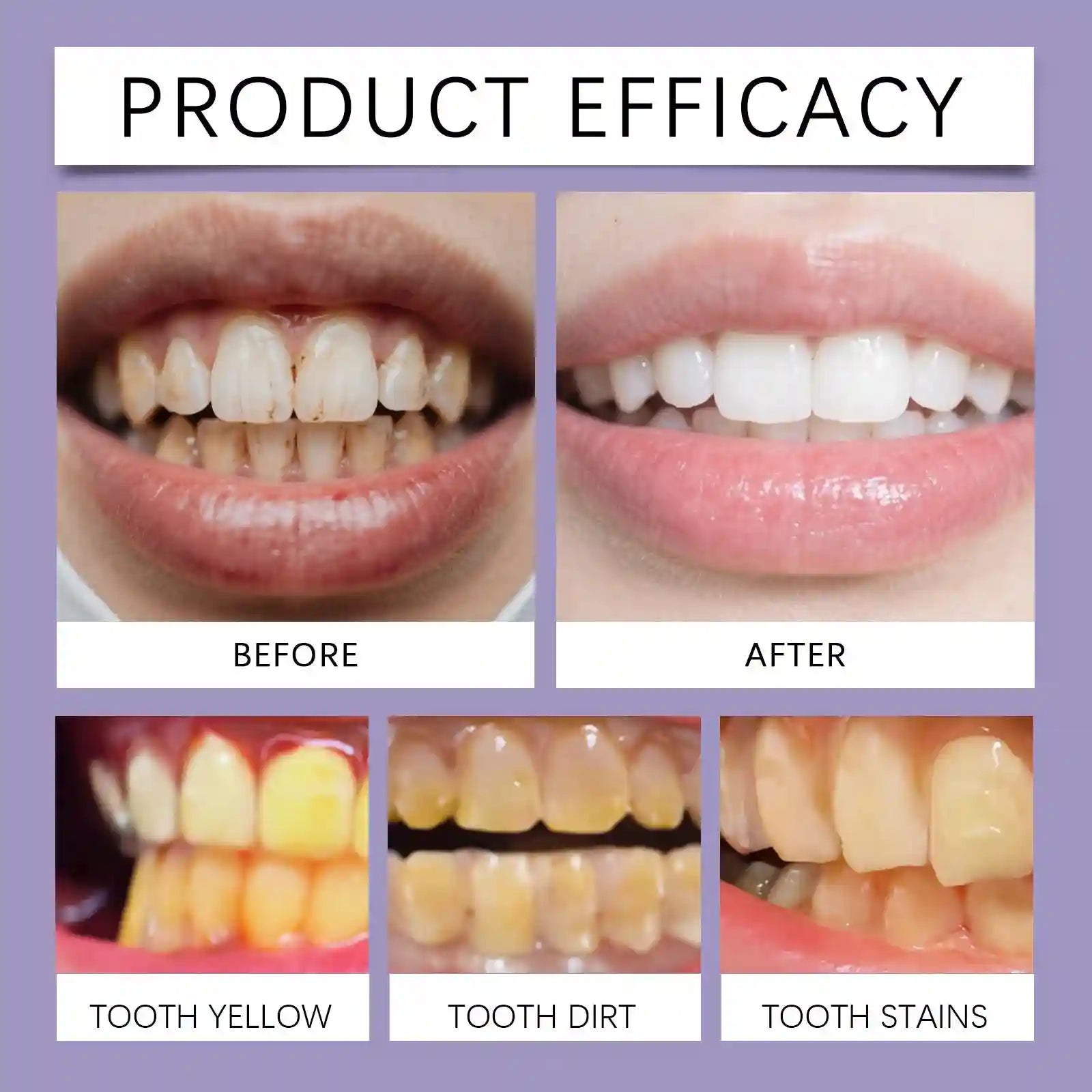 Tidesmit Bee Venom teeth whitening toothpaste for deep cleaning, stain removal, and fresh mint breath.