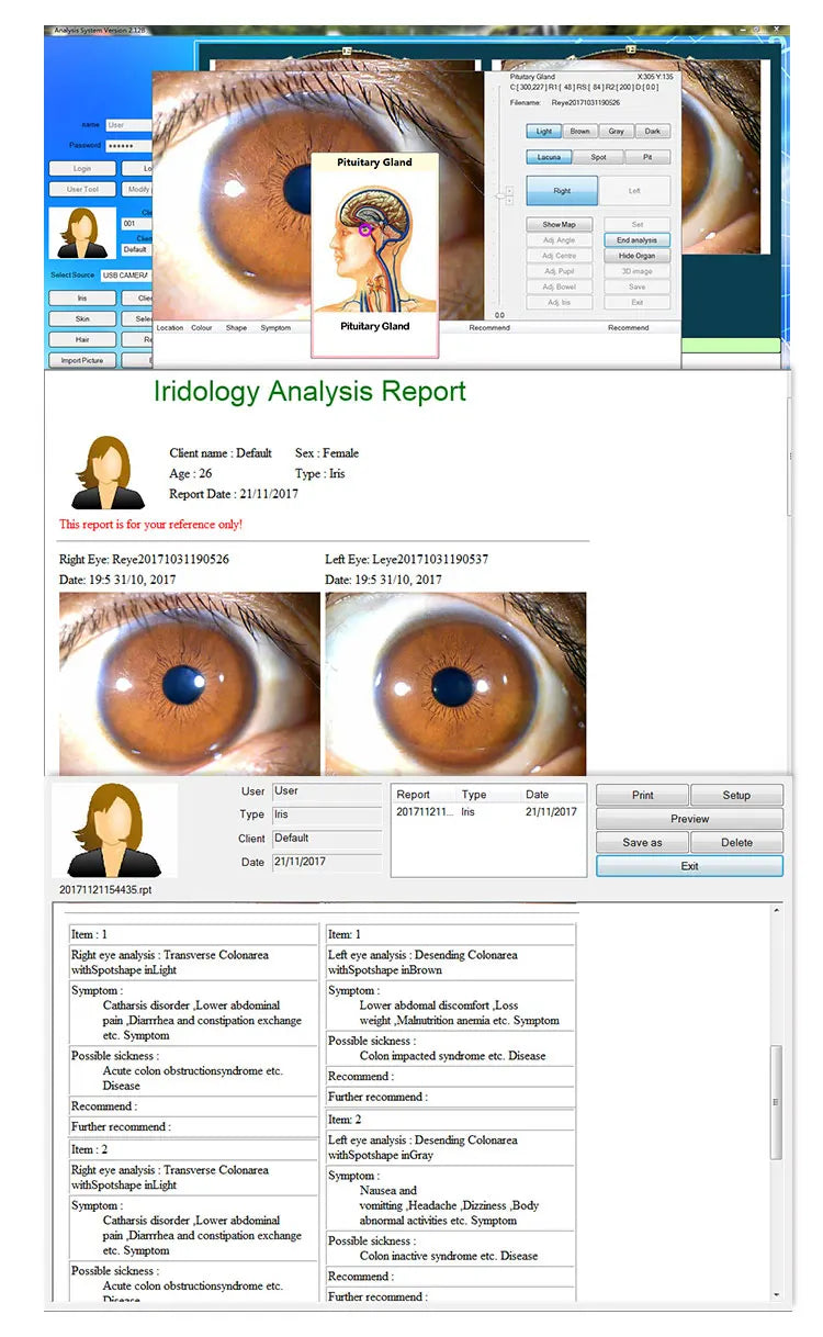Iris Analyzer System - 12MP Wireless Digital Iridology Health Tool Body Shaping Massage Equipment Tidesmit