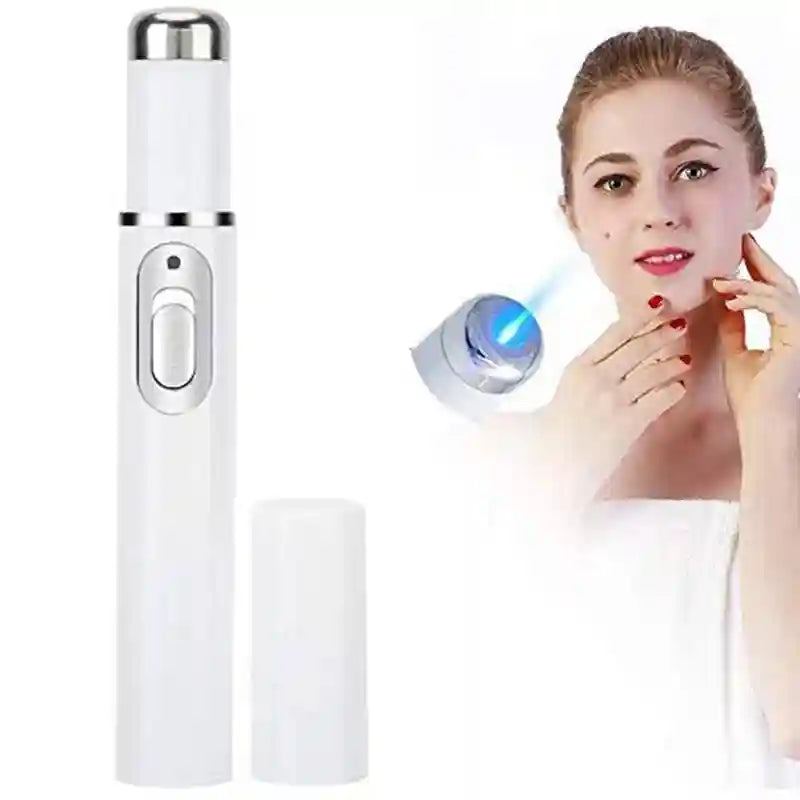 Eye Massage Instrument - Sonic Vibration Device for Dark Circles (White) Eye Massage Instrument Tidesmit
