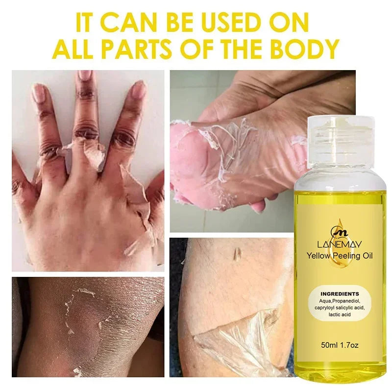 Yellow Peeling Oil for Body Exfoliation - Professional Brightening Serum Scrubs Treatments Tidesmit