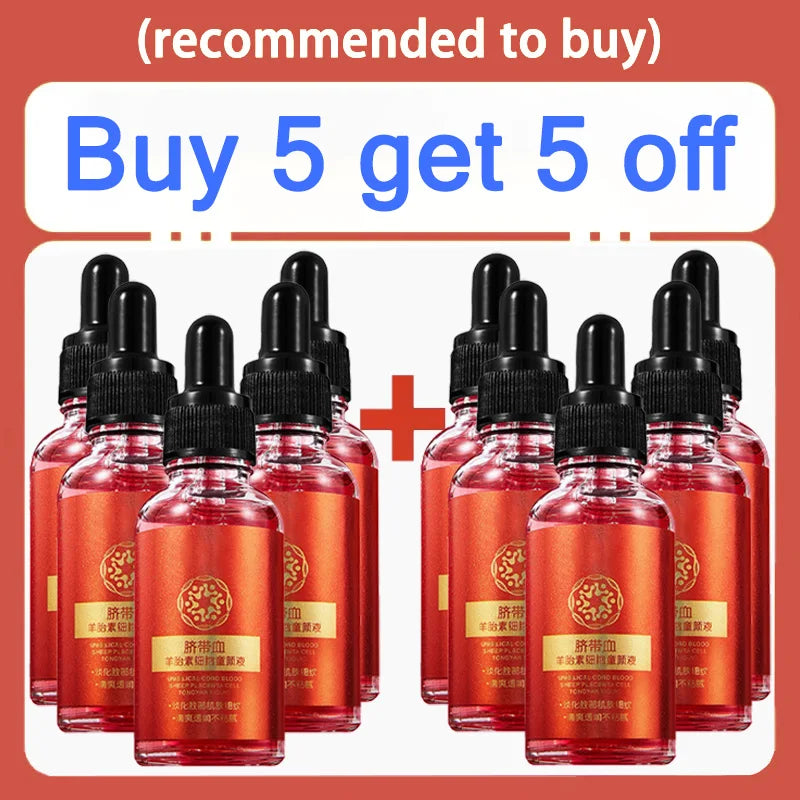 30ml Umbilical Cord Sheep Placenta Serum in dropper bottles for delicate, moisturizing skin care. Pack of 10 vials.