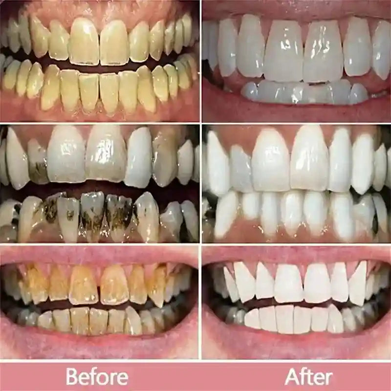 Tidesmit whitening toothpaste for yellow teeth removal and professional oral hygiene cleaning