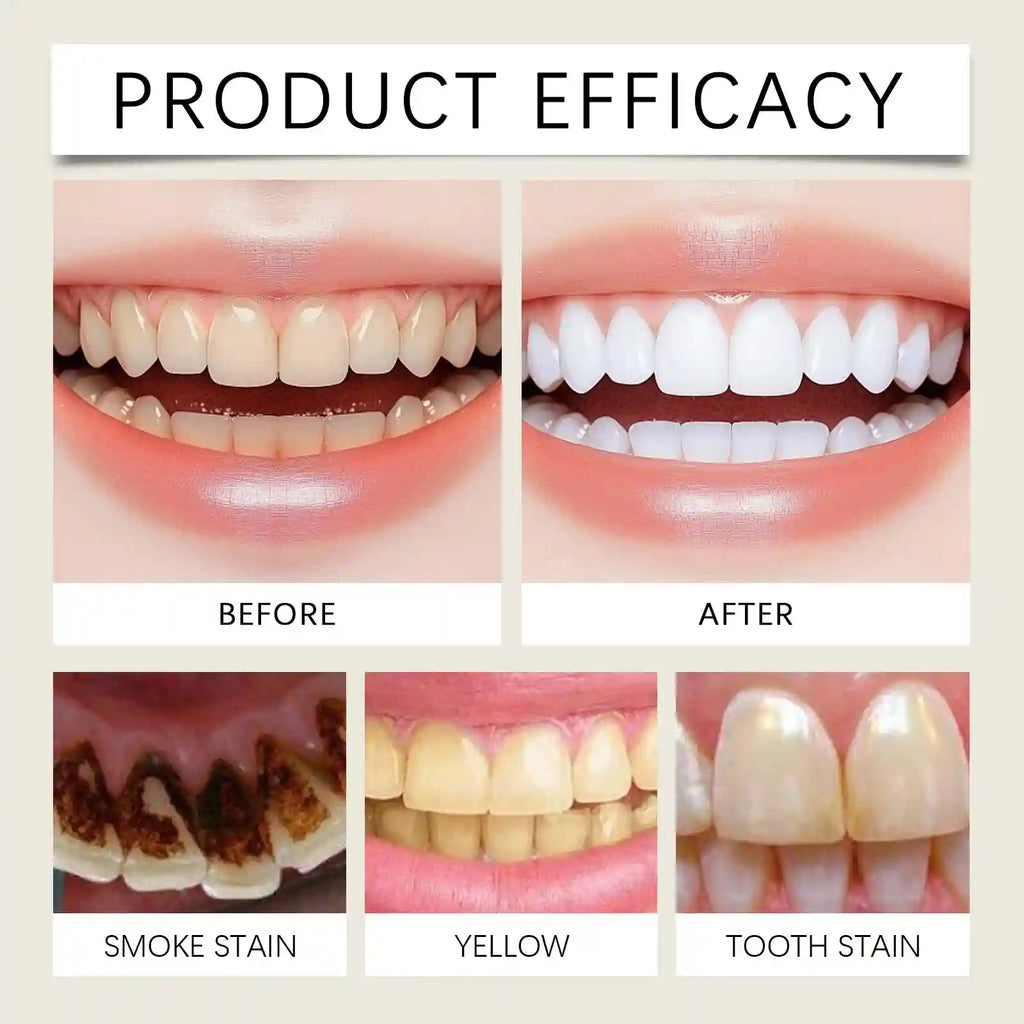 Tidesmit hydroxyapatite whitening toothpaste for deep cleaning and effective stain removal for brighter teeth.