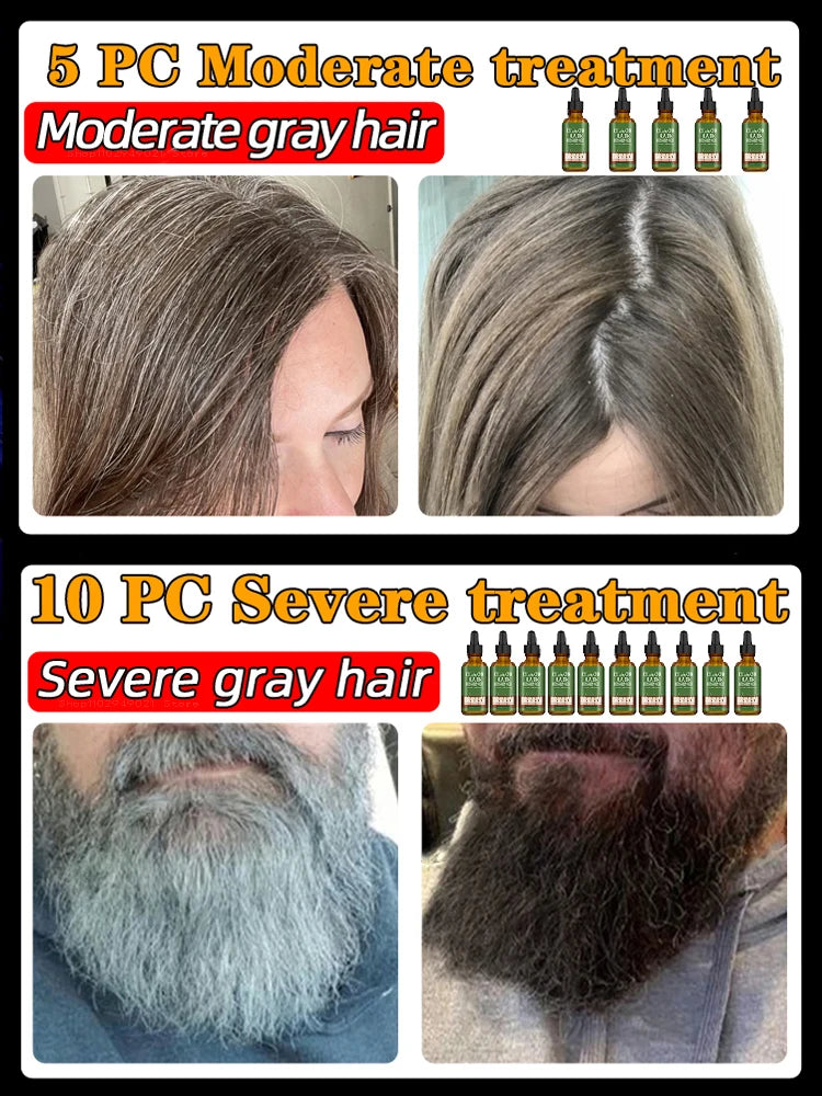 Anti Gray Hair Serum – Natural Scalp Nourishing Darkening Care Lip Care Tidesmit