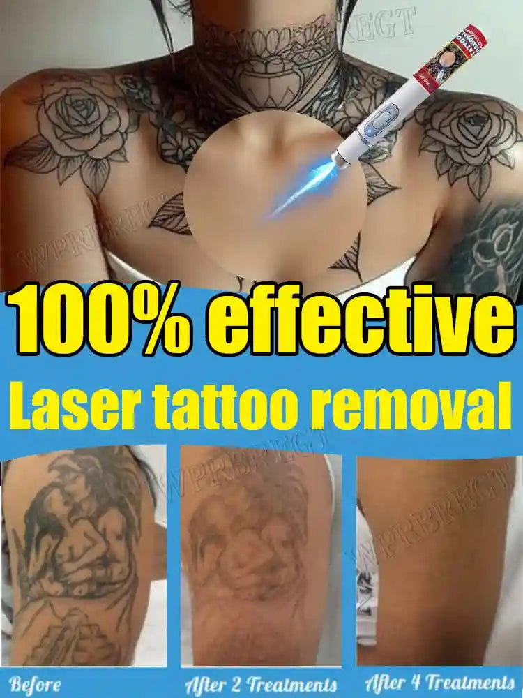 Tattoo Removal Cream for Body and Face - Professional Fast Action Formula Scrubs Treatments Tidesmit