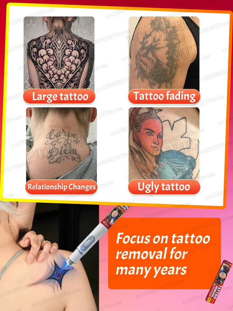 Nano Laser Tattoo Removal Machine - Professional PMU Device Permanent Makeup Machines Tidesmit