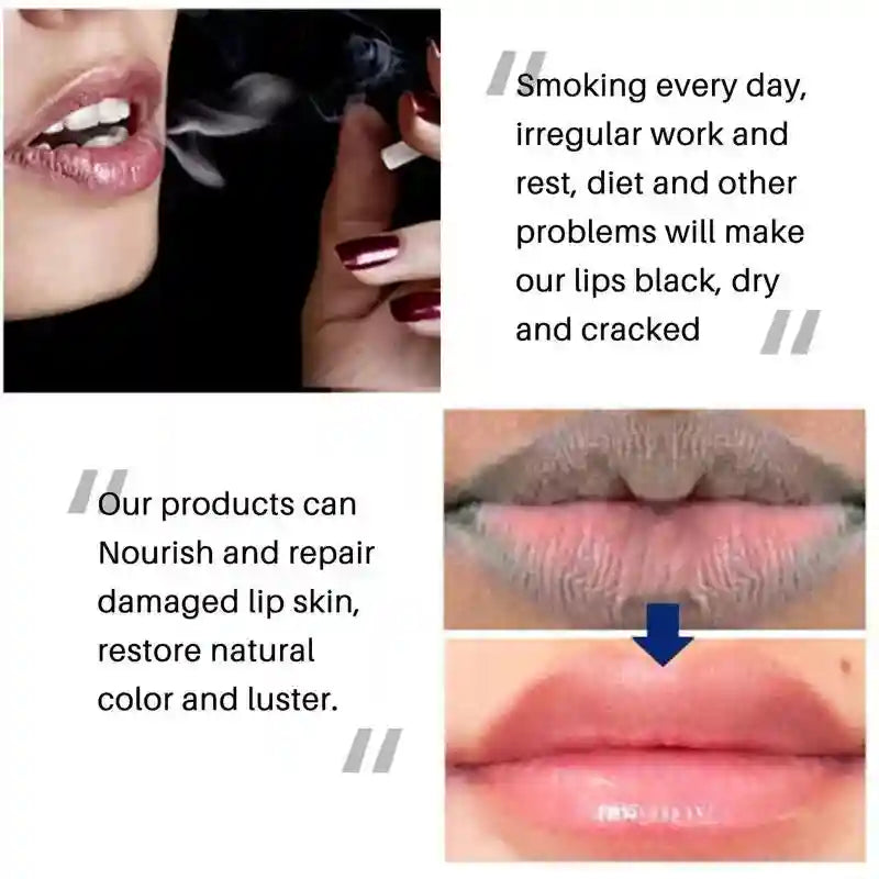 Pink Lip Lightening Serum for Dark Lips - Moisturizing Lip Care Lip Care Tidesmit