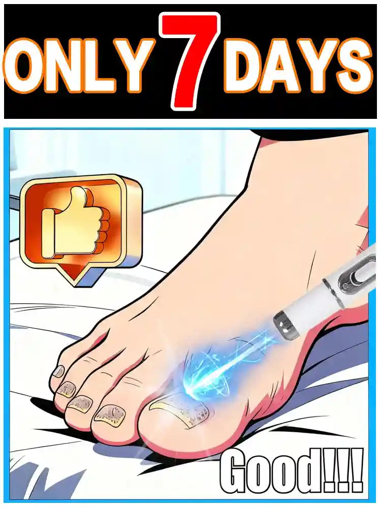 Nail Laser Pen for Onychomycosis - Portable Home Wellness Device Relaxation Treatment Tidesmit