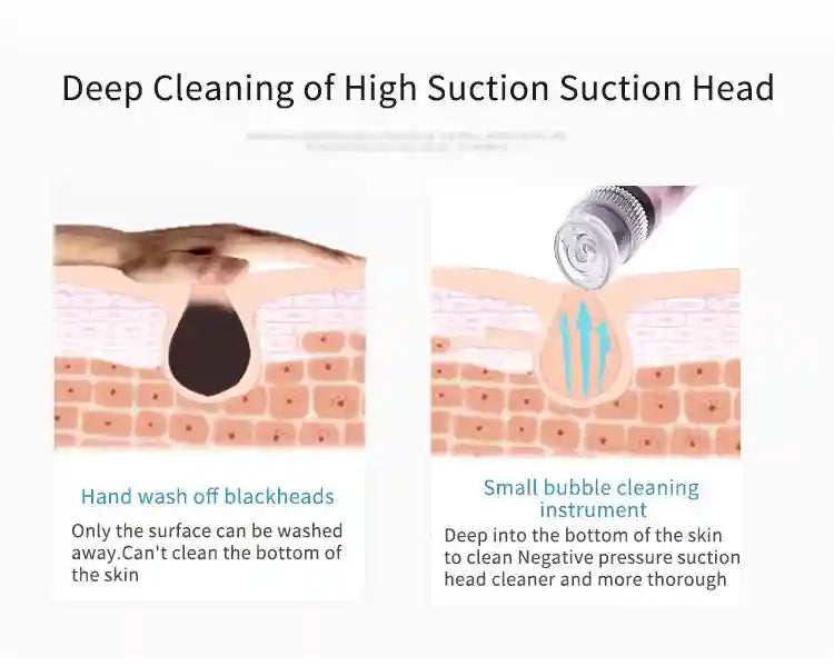Hydro Facial Machine for Deep Pore Cleansing and Blackhead Extraction Eye Massage Instrument Tidesmit